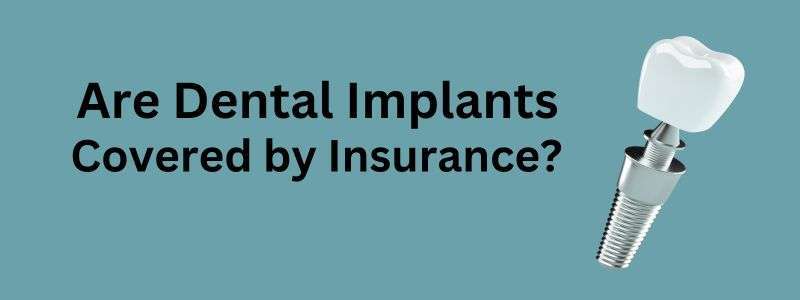 Dental Implants Covered by Insurance