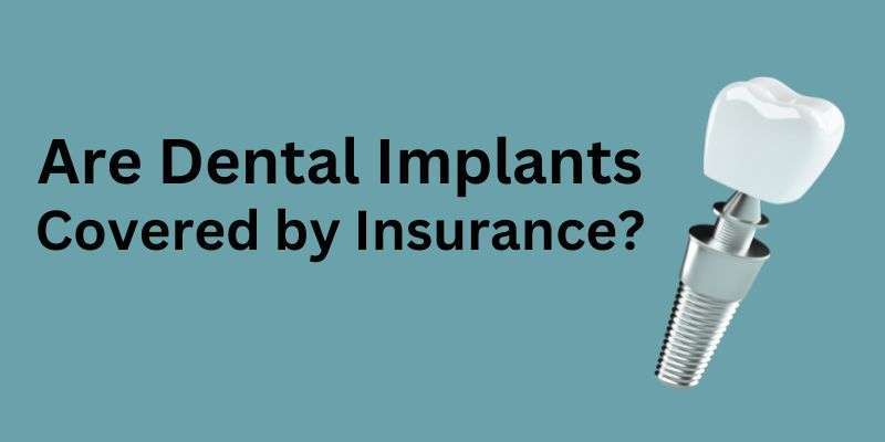 Dental Implants Insurance