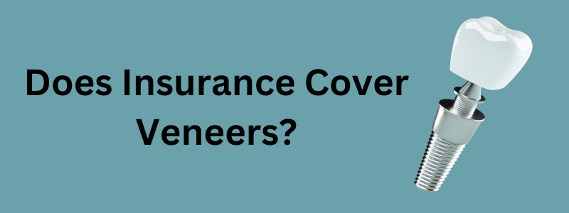 Does Insurance Cover Veneers